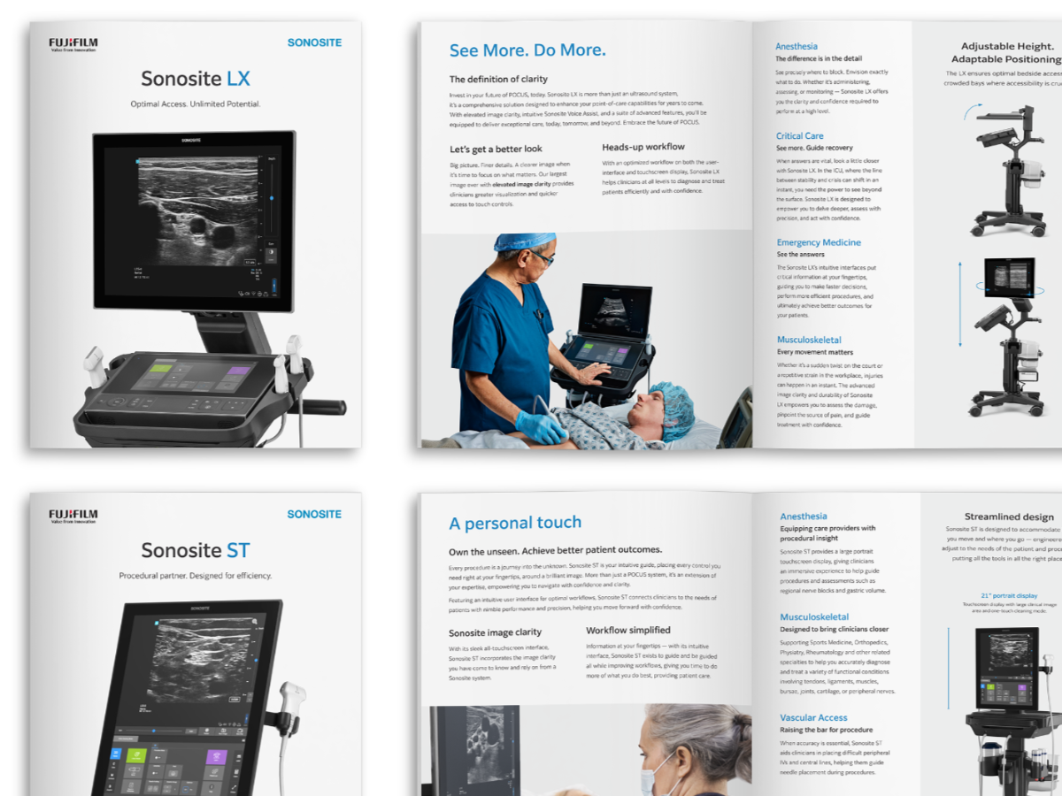 Sonosite brochures